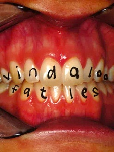 Vindaloo Copertina